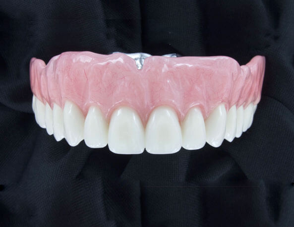 Complete-Denture