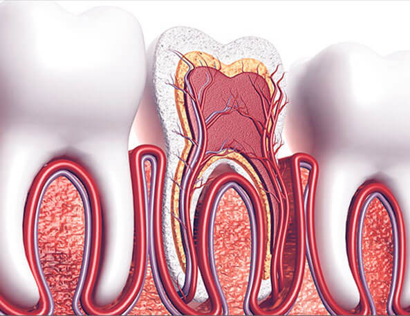 Root-canal