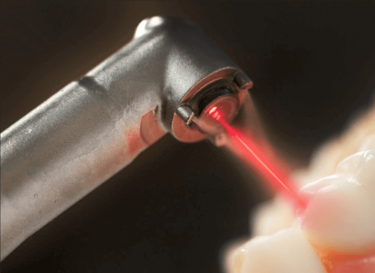 laser-dentistry1-768×561-1