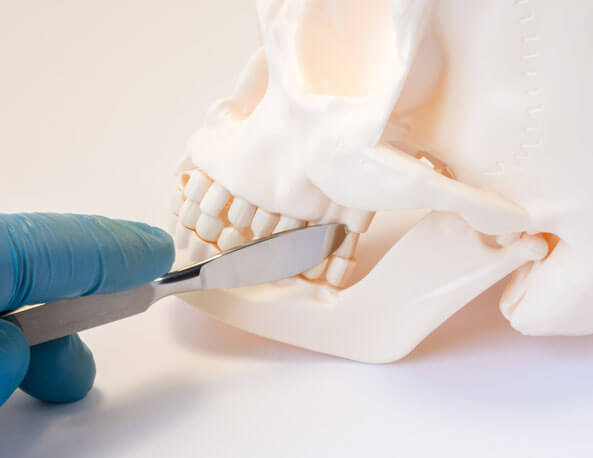 maxillofacial-trauma